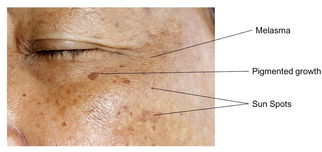 Pigmentation des sourcils à Genève