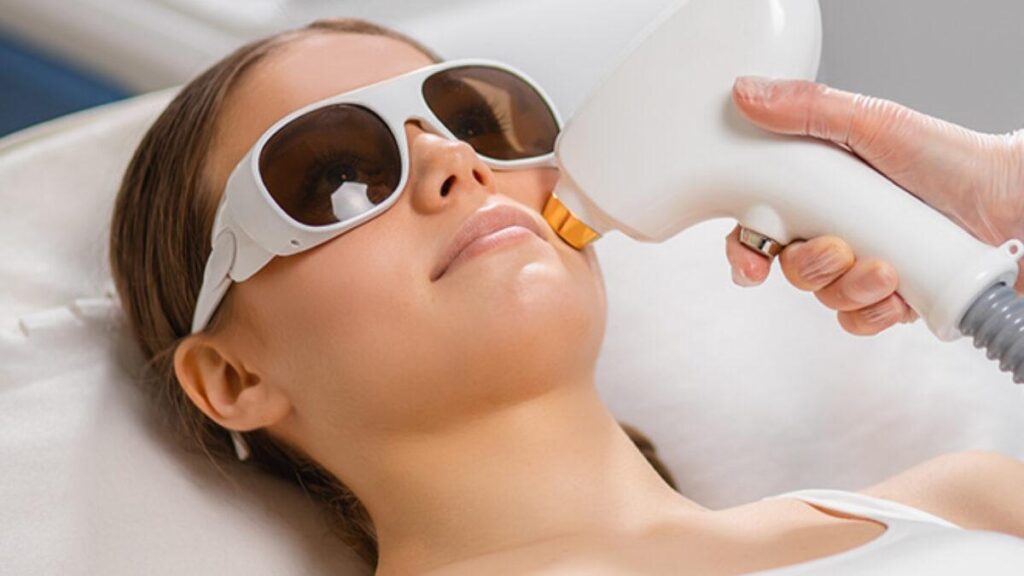 Épilation laser des sourcils à Genève