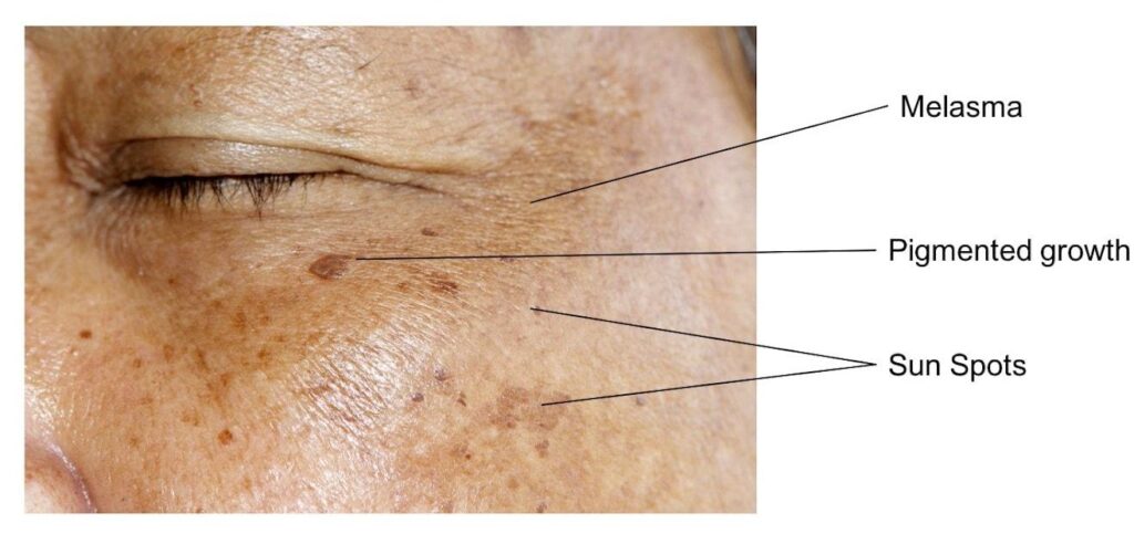 Pigmentation des sourcils à Genève